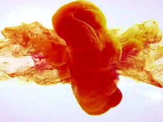 Dive Into Golden Pee!