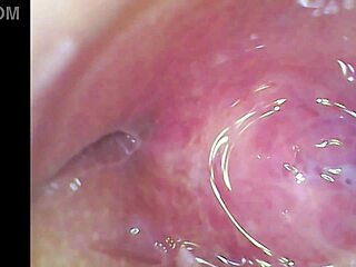 watch real pussy contractions during orgasm with sperm inside