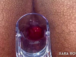 wow anal vision with speculum on mature bbw's hairy big ass 😈