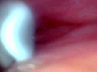 Endoscope spies hot male cum explosion inside?